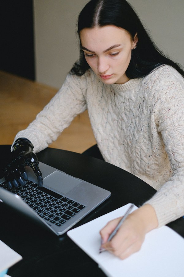 Young person with a prosthetic arm working at computer